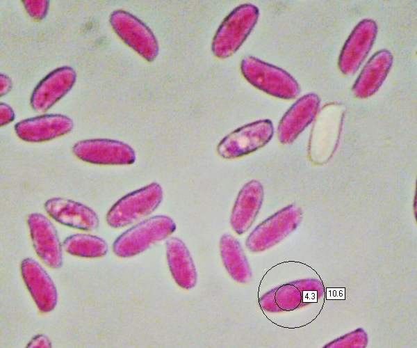 Microscopic image of oyster mushroom spore - Mushrooms spored