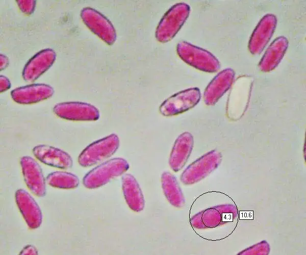 Microscopic image of oyster mushroom spore - Mushrooms spored